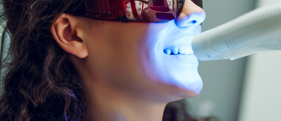 Girl patient in the dental clinic. Teeth whitening UV lamp with